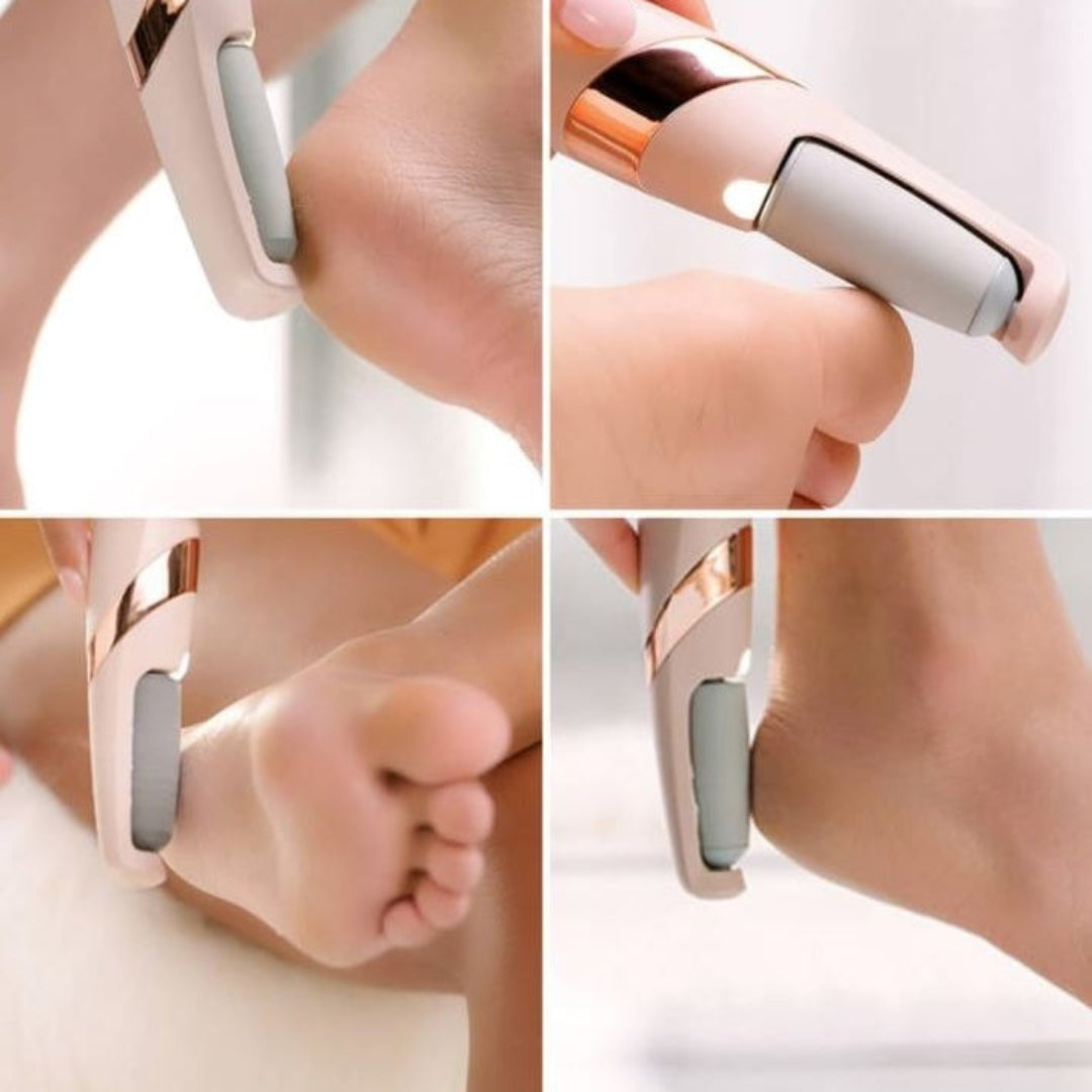 Rechargeable Electric Pedi Callus Remover Tool for Feet